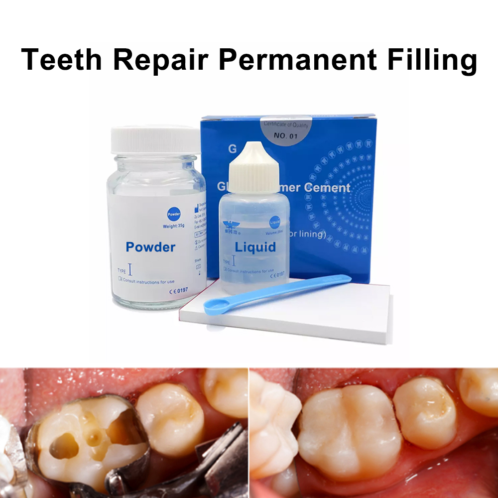 Teeth Whitening Kit At Home - 구강 구멍 필러 치아 충치 복원