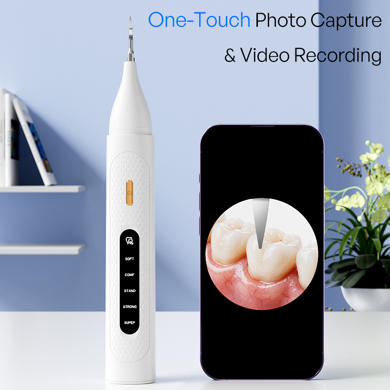 가시광선 초음파 치아 세척기 비디오 전동 스케일러 카메 - Teeth Whitening Video 리뷰 및 가격