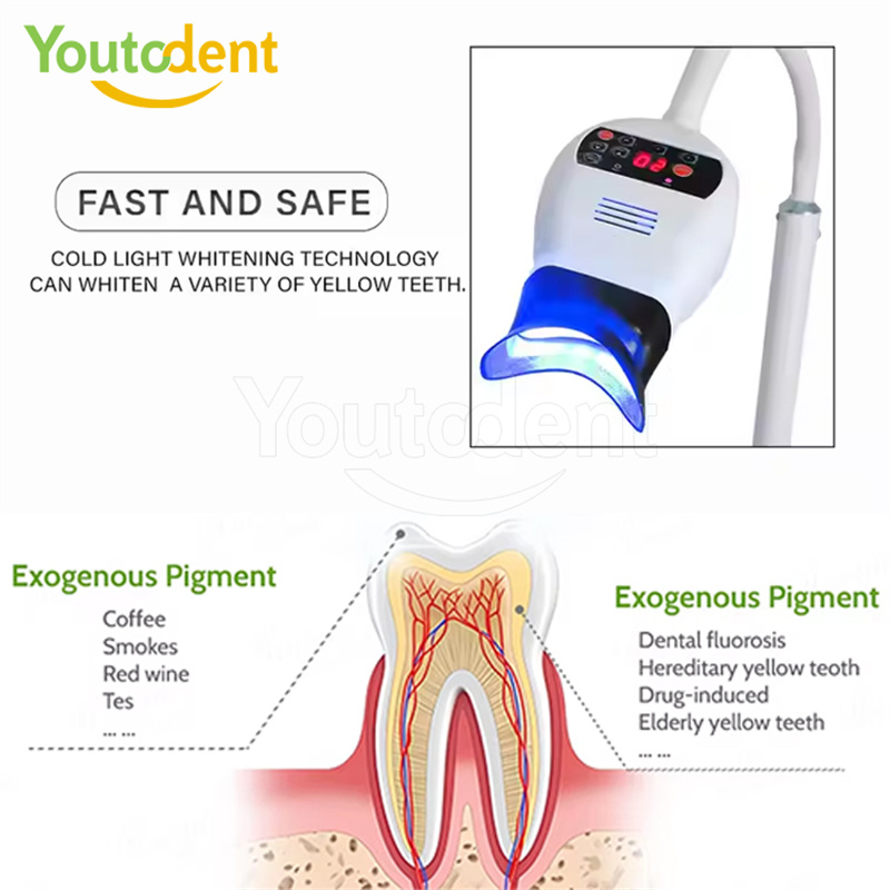 전문 치과용 3색 광 램프 치아 미백기 미백 촉진 장치 - Teeth Whitening Professional 리뷰 및 가격