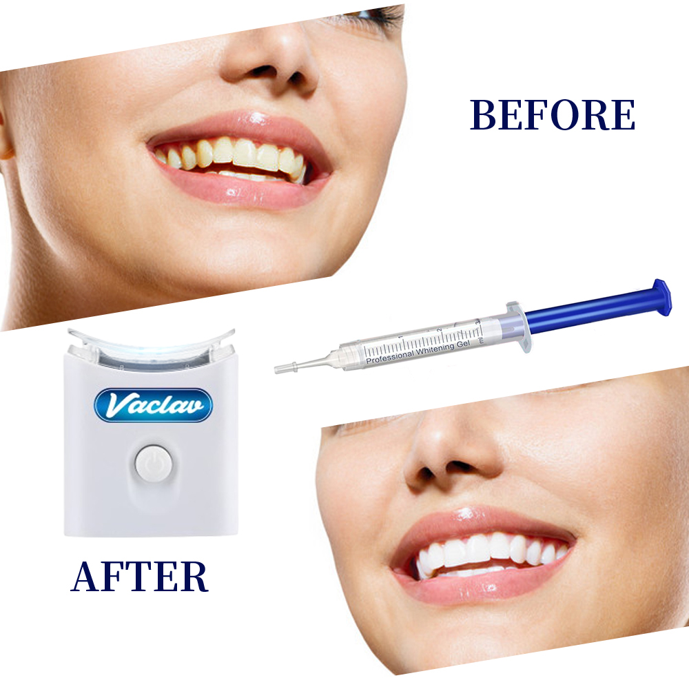 민트 치아 미백 젤 주사기 가정용 치아 미백 키트 LE - Teeth Whitening Kit At Home 리뷰 및 가격