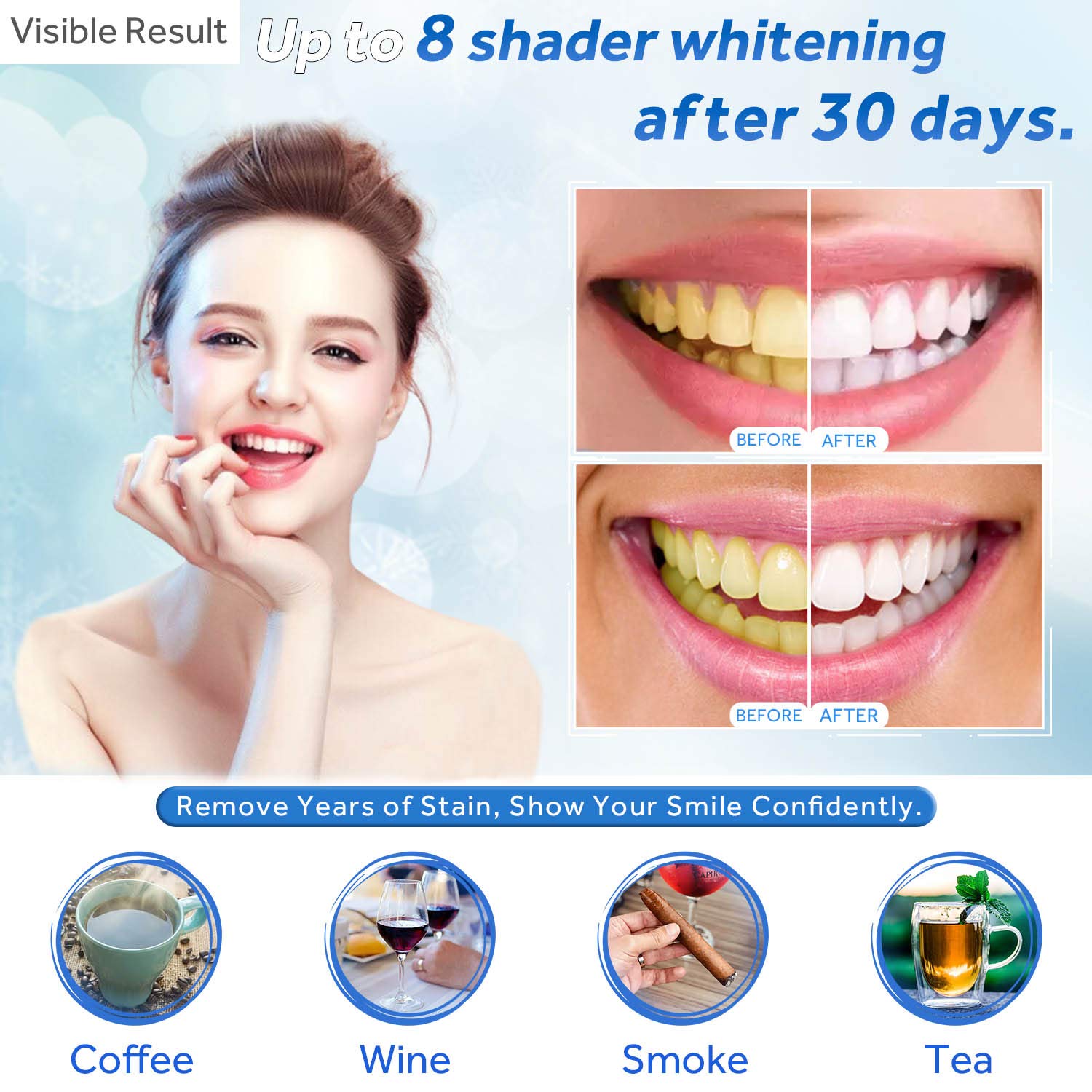 치아 미백 젤 리필 주사기 치아 미백 젤 인비스알라인  - Teeth Whitening Mask 리뷰 및 가격