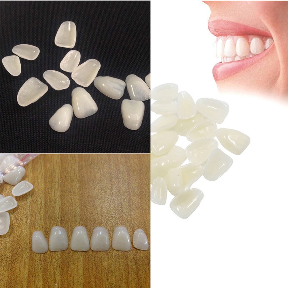 치과용 초박형 미백 베니어, 송진 치아, 상부 전방 핫 - Teeth Whitening Mask 리뷰 및 가격