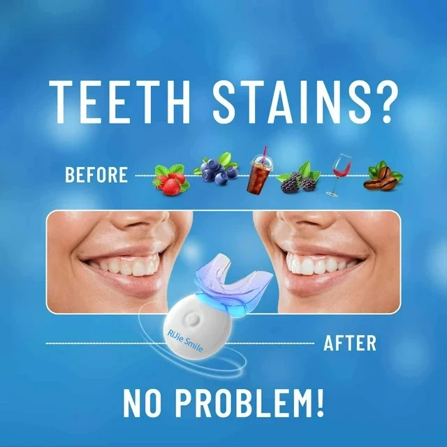 고품질 무선 치아 미백 키트, 가정용 치아 미백 키트 - Teeth Whitening Kit At Home 리뷰 및 가격