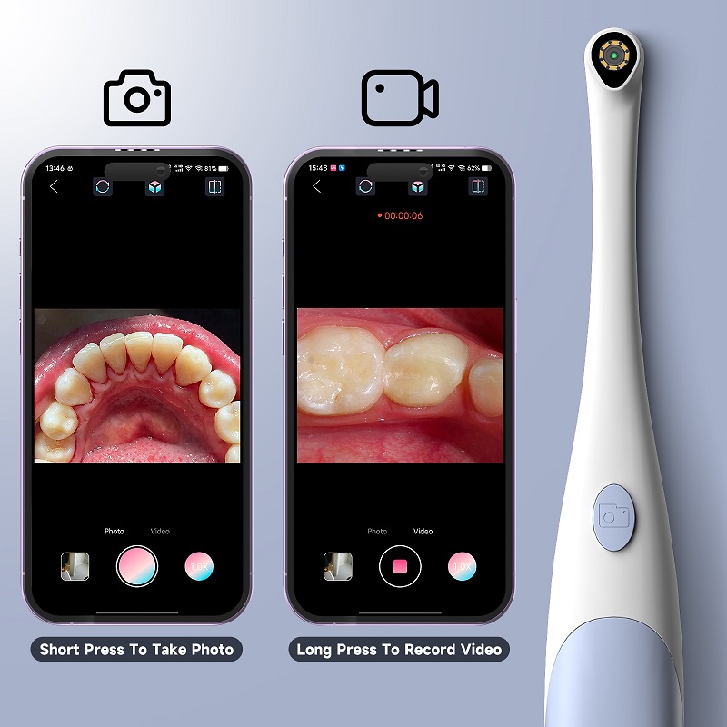 구강 내시경 카메라 1440P 사진 및 비디오 휴대용  - Teeth Whitening Video 리뷰 및 가격