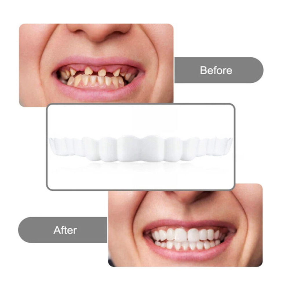 4-6 쌍 상부 및 하부 턱 틀니 틀니 치아 틀니 관리 - Teeth Whitening Mask 리뷰 및 가격