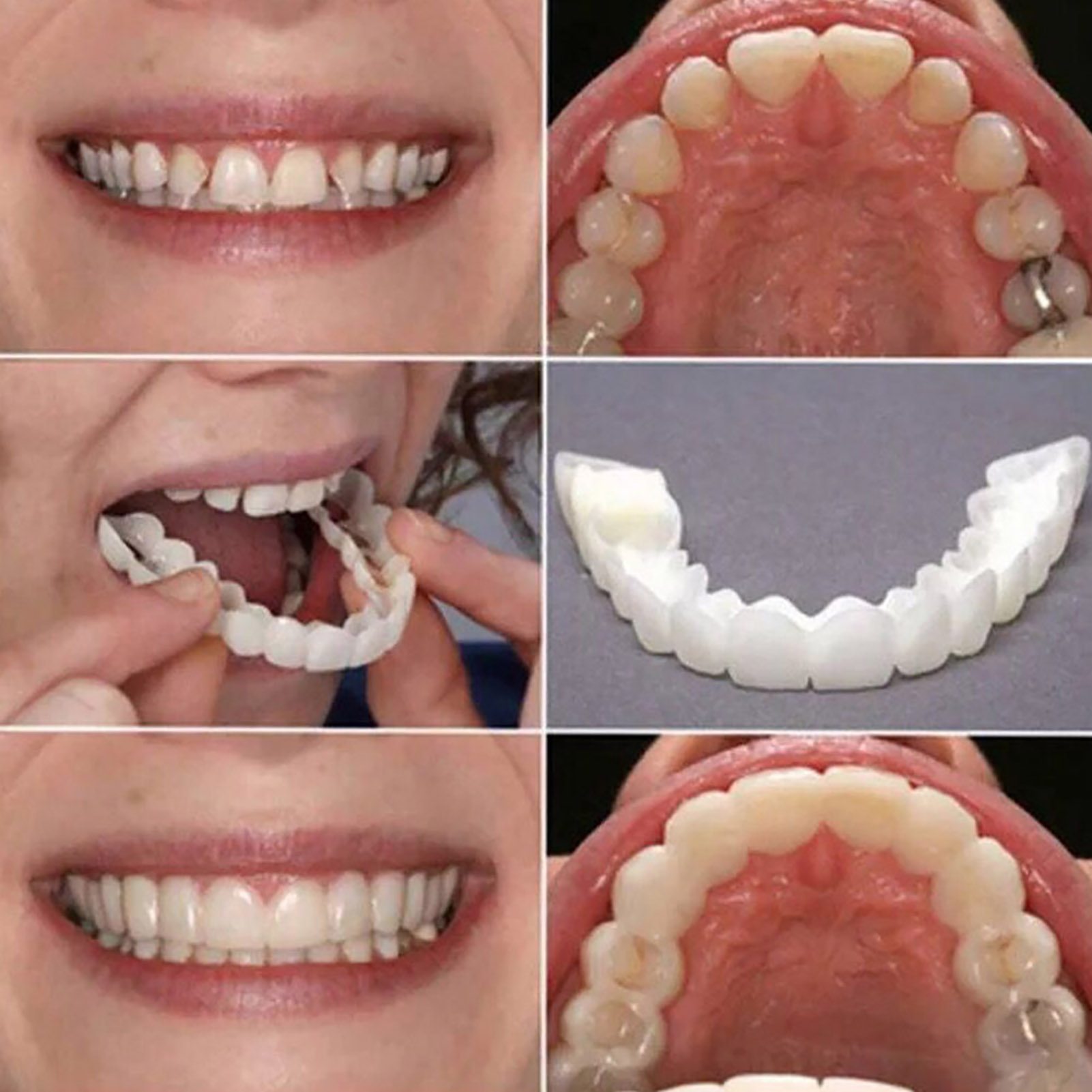 핫 티스 베니어 화이트닝 틀니 교정기 임시 가짜 치아  - Teeth Whitening Mask 리뷰 및 가격