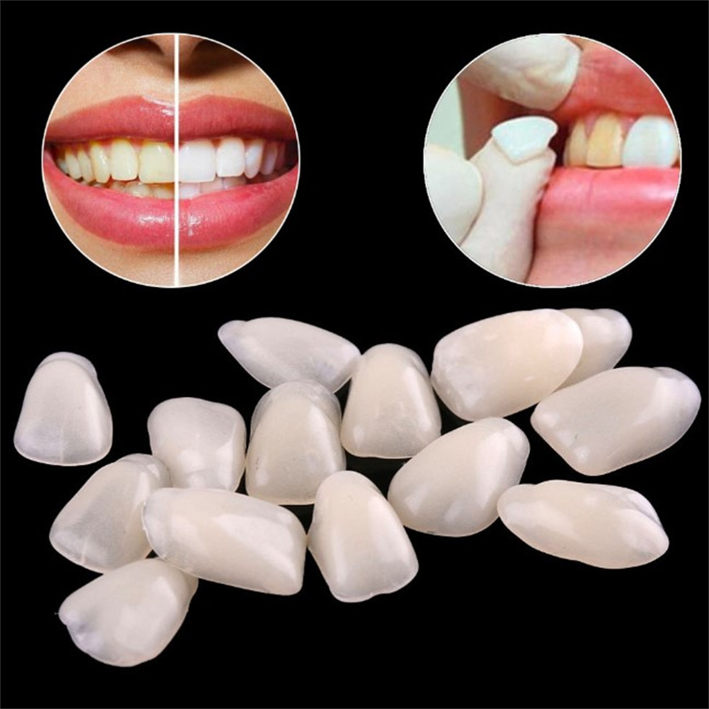 임시 치아 베니어 - 치아 미백 및 앞니 강화를 위한  - Teeth Whitening Mask 리뷰 및 가격