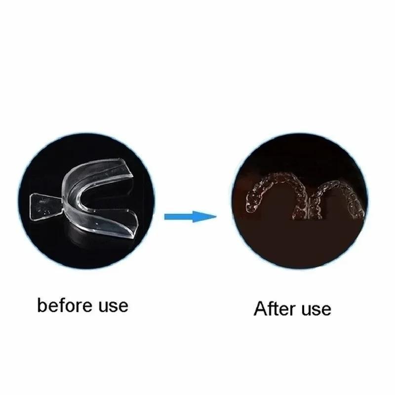 전문 치아 미백 트레이 치아 보호대 잇몸 치과 제품 치 - Teeth Whitening Kit At Home 리뷰 및 가격