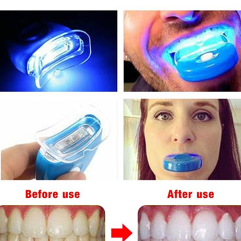 블루 LED 치아 미백 가속기, UV 라이트 치과 레이 - Teeth Whitening Video 리뷰 및 가격