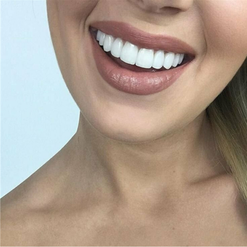 치아 미백 베니어 임시 틀니 완벽한 미소 변화를 위한  - Teeth Whitening Mask 리뷰 및 가격