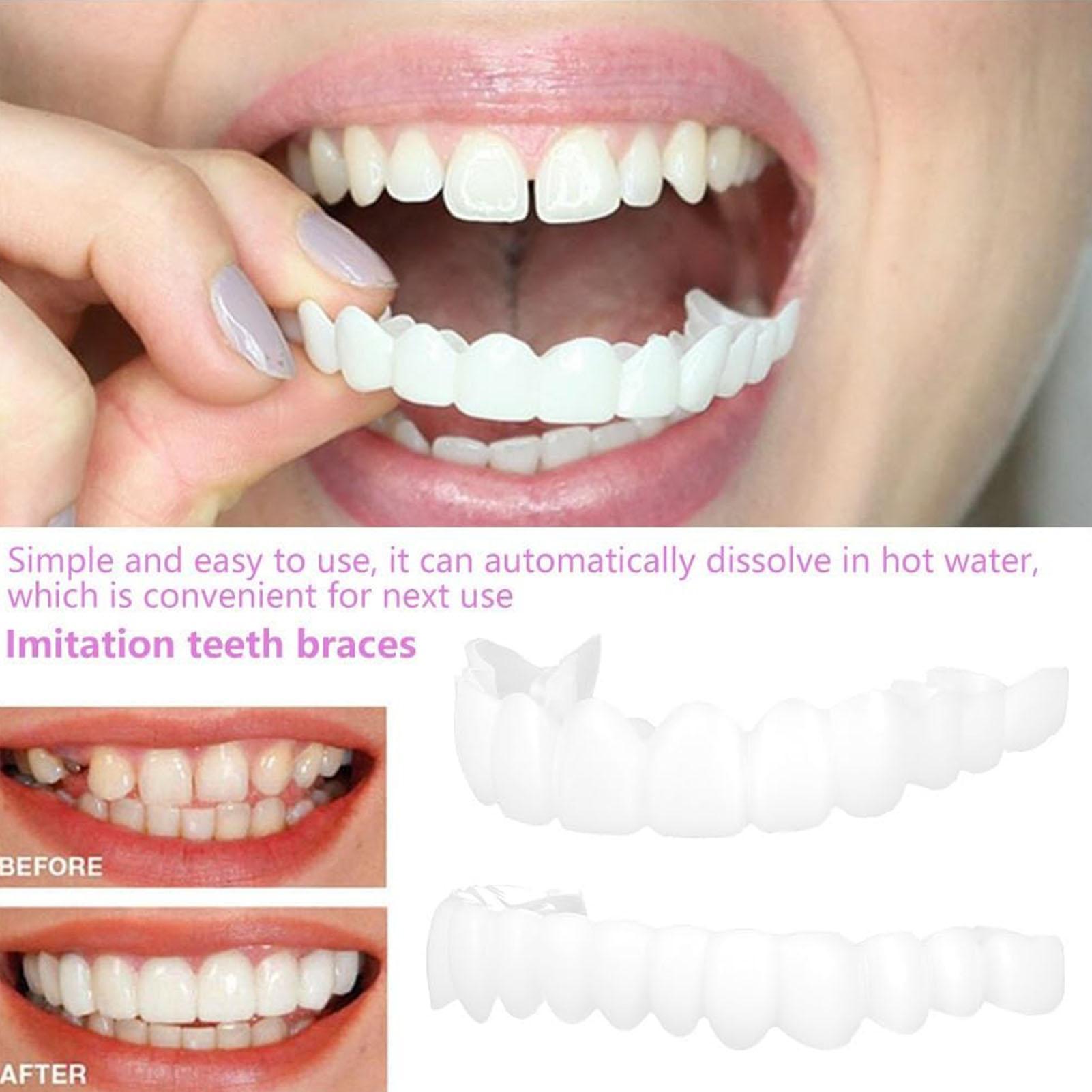남녀 공용 임시 치아 베니어 상하악용 임시 미소 개선기 - Teeth Whitening Mask 리뷰 및 가격