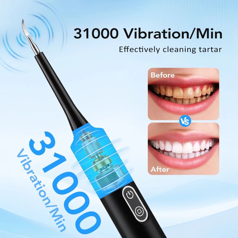 전동 음파 진동 치석 제거기 치아 미백 플라그 제거 치 - Teeth Whitening Professional 리뷰 및 가격